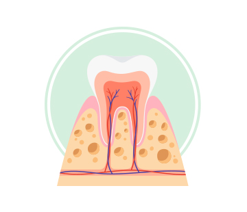 아산 온양온천역 치과 잇몸질환 단계