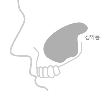 정직한 진료, 믿을 수 있는 결과 바로플란트치과 상악동거상술